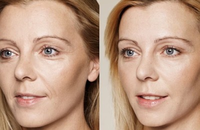 澳洲mmV胶原蛋白肽重新定义美容内服赛道，用全球顶尖学术佐证抗衰功效